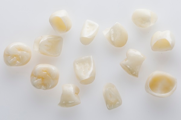 The Difference Between Dental Inlays And Dental Crowns