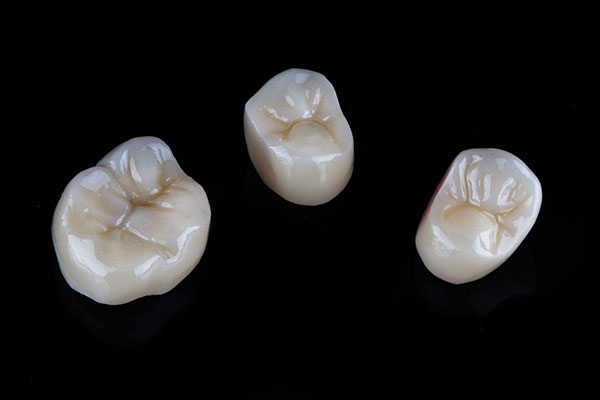 A Comparison of Dental Crown Materials from Frankford Dental Care in Philadelphia, PA