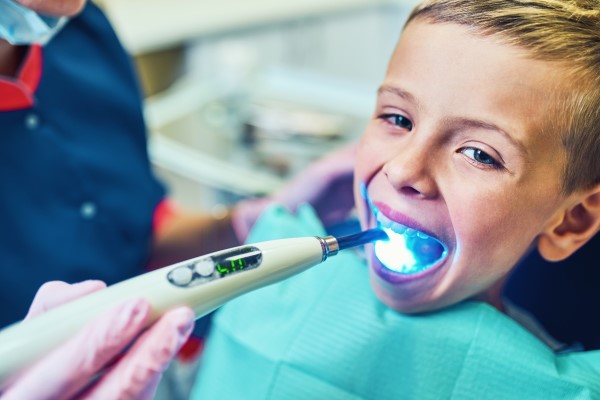 Commonly Asked Questions About Dental Sealants For Kids