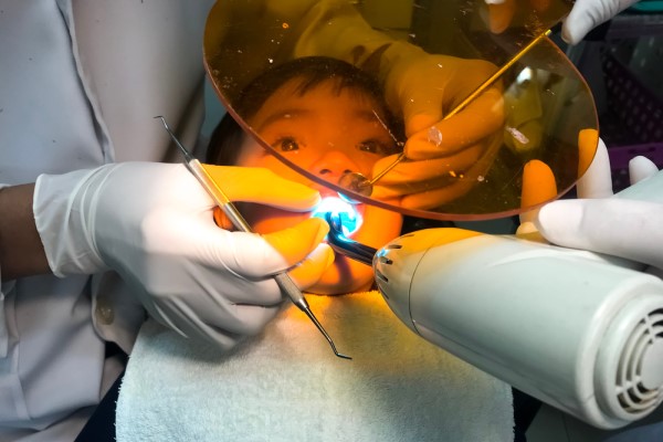 Dental Sealants To Reduce Risk Of Tooth Decay