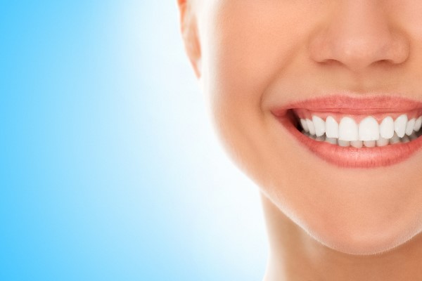 Everything You Need To Know About Dental Veneers