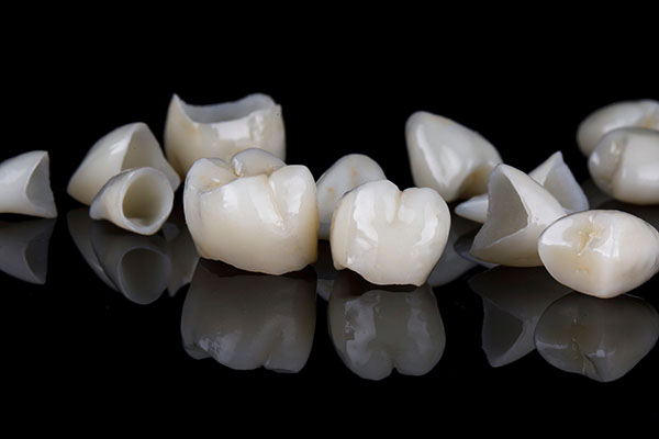 What Are the Differences Between a Dental Crown and a Dental Veneer? from Frankford Dental Care in Philadelphia, PA