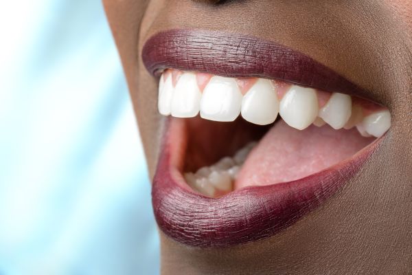 Questions To Ask About A Full Mouth Reconstruction