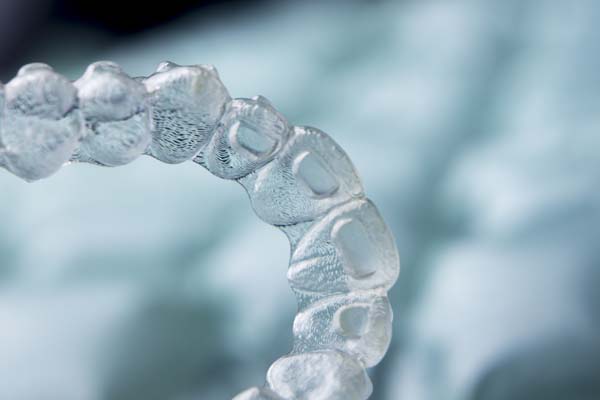 Invisalign Is An Option For Teeth Straightening