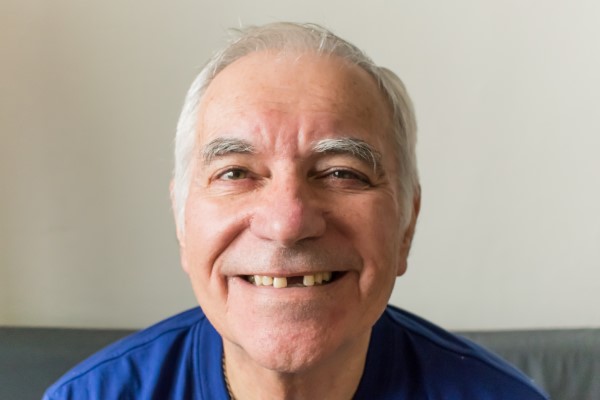 Replacing A Missing Tooth: Why It Is Necessary And How We Can Help