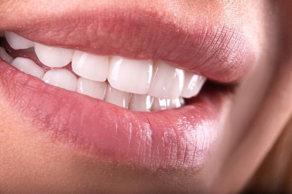 What To Discuss At Your Smile Makeover Consultation