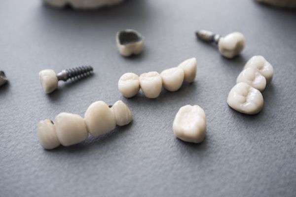 Types of Dental Implants from Frankford Dental Care in Philadelphia, PA
